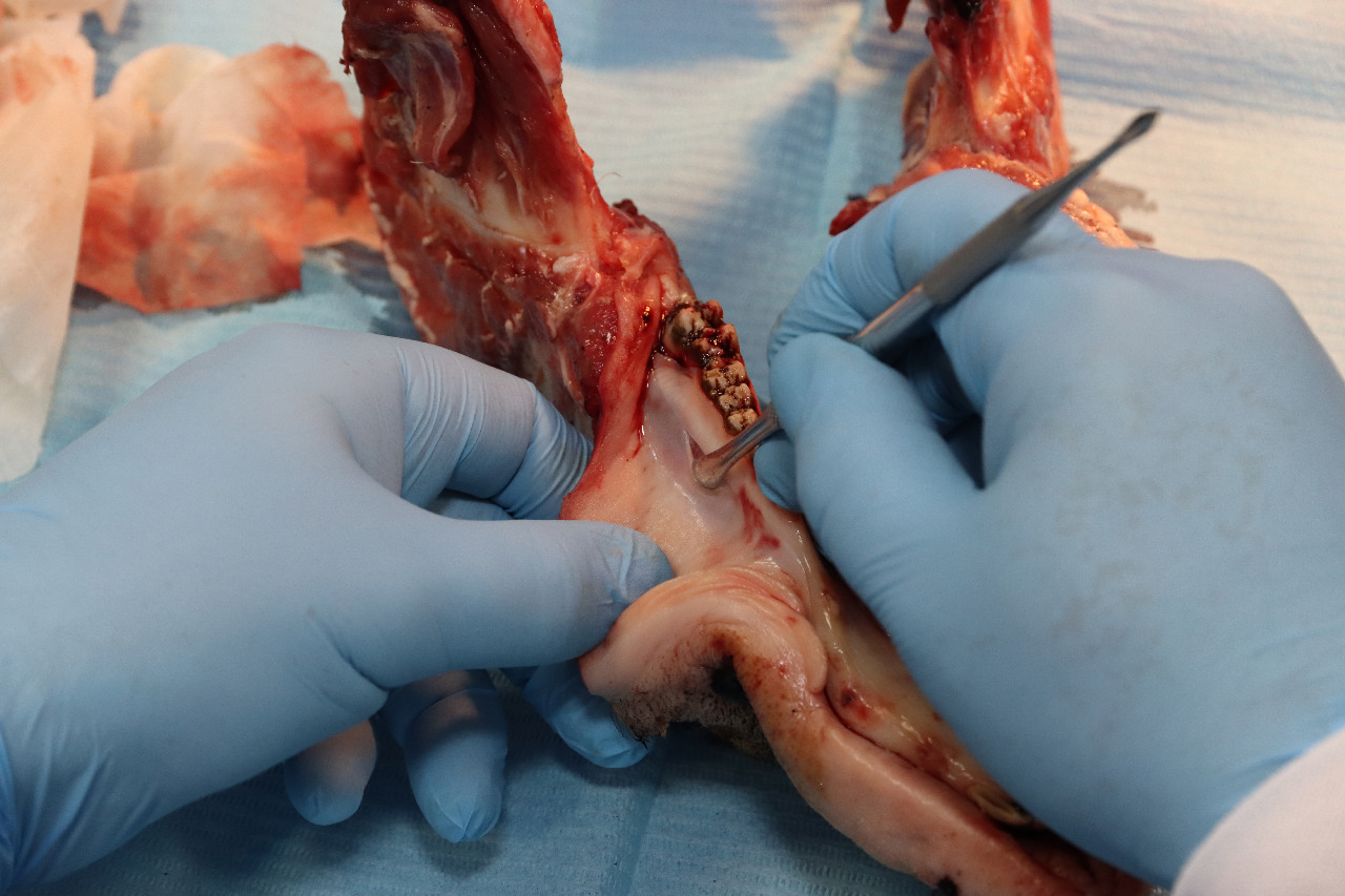 Продвинутый курс по пластике мягких тканей