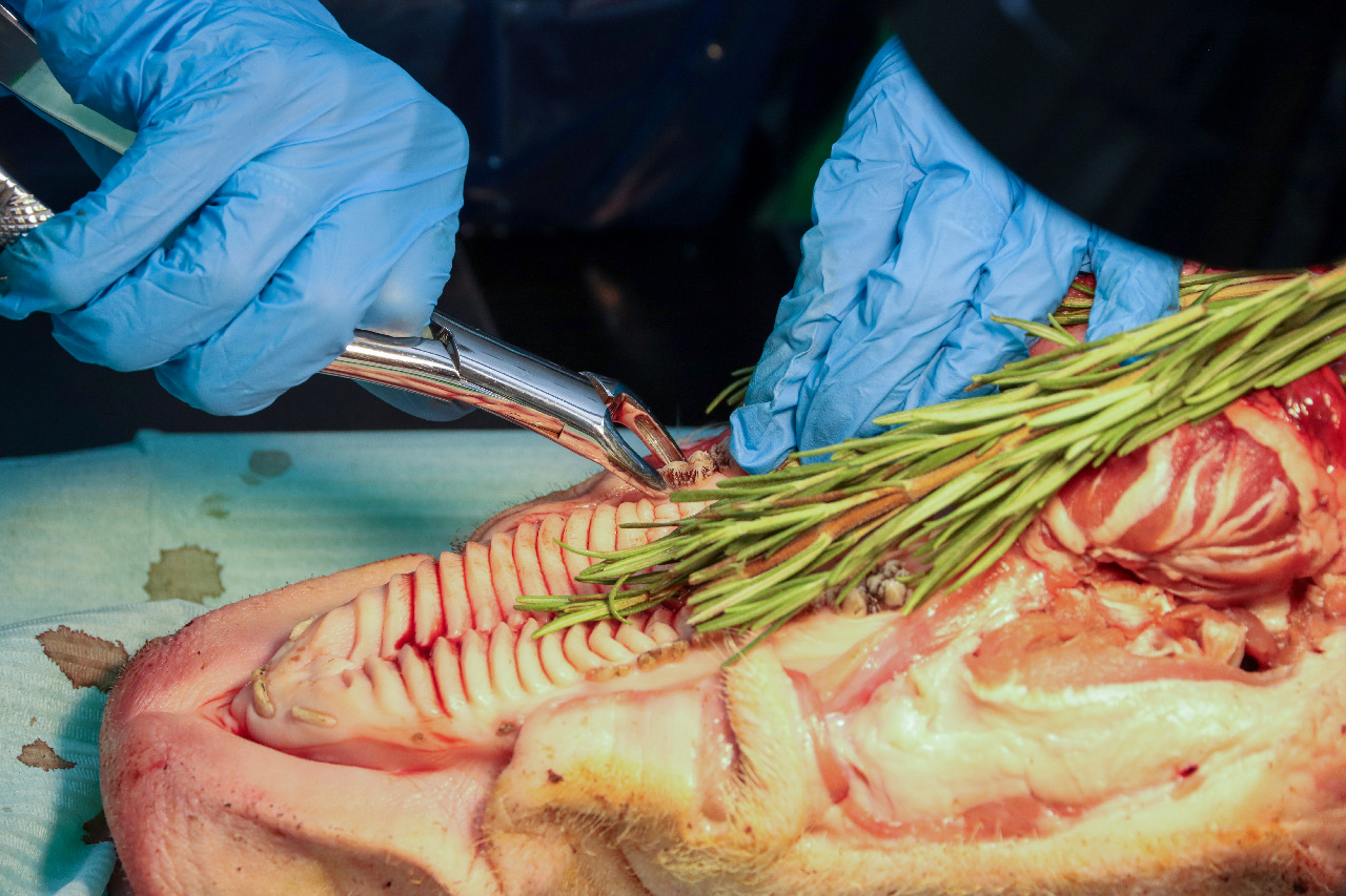 Атравматичное удаление зубов и методики наложения швов