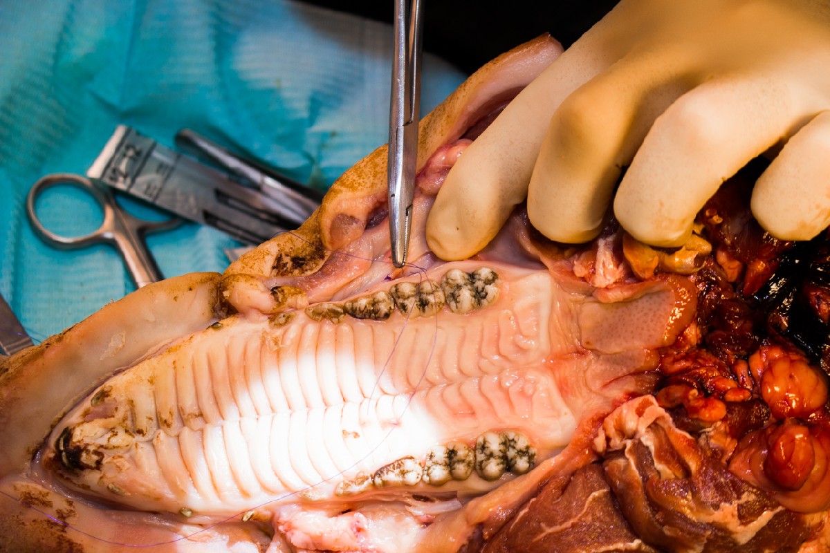 20-21 февраля 2020. Панцулая В.Г. Пластика мягких тканей вокруг имплантатов. Морфологический подход