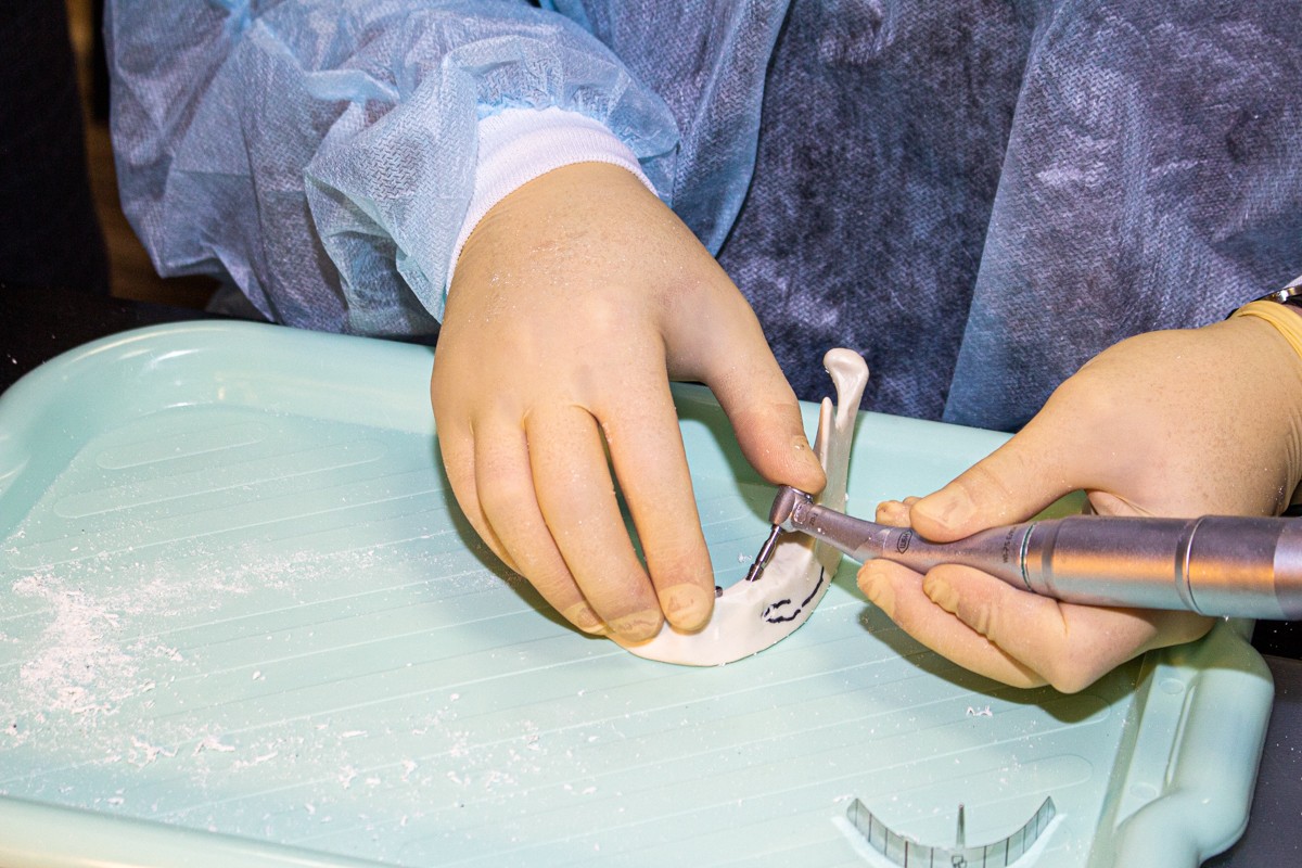 Стоматологическая реабилитация с помощью ангулированных имплантатов. 5 февраля 2020, Данилов Александр Алексеевич