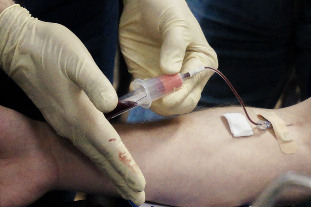 Применение факторов роста (IPRF, APRF) в хирургии и костной пластике