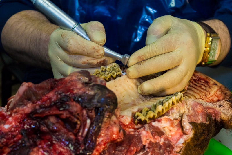 Одномоментная имплантация и немедленная нагрузка