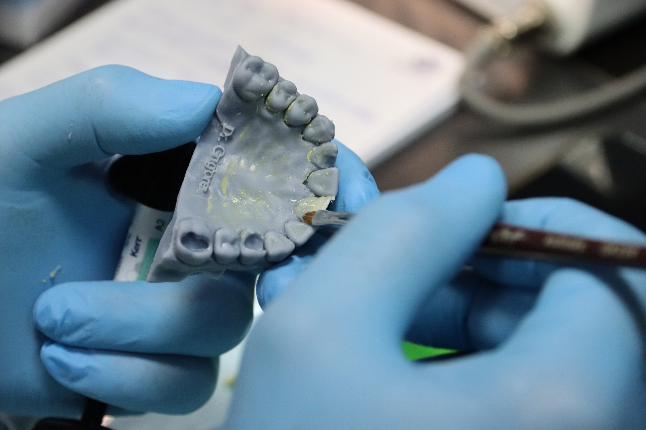 Прямые композитные виниры. Полный алгоритм и немного больше