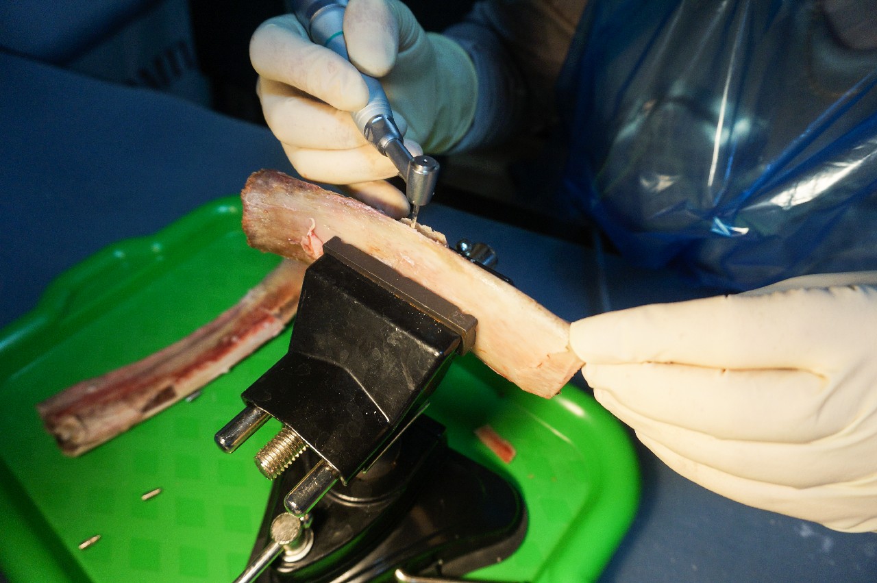 Продвинутый курс по имплантации. Костная пластика