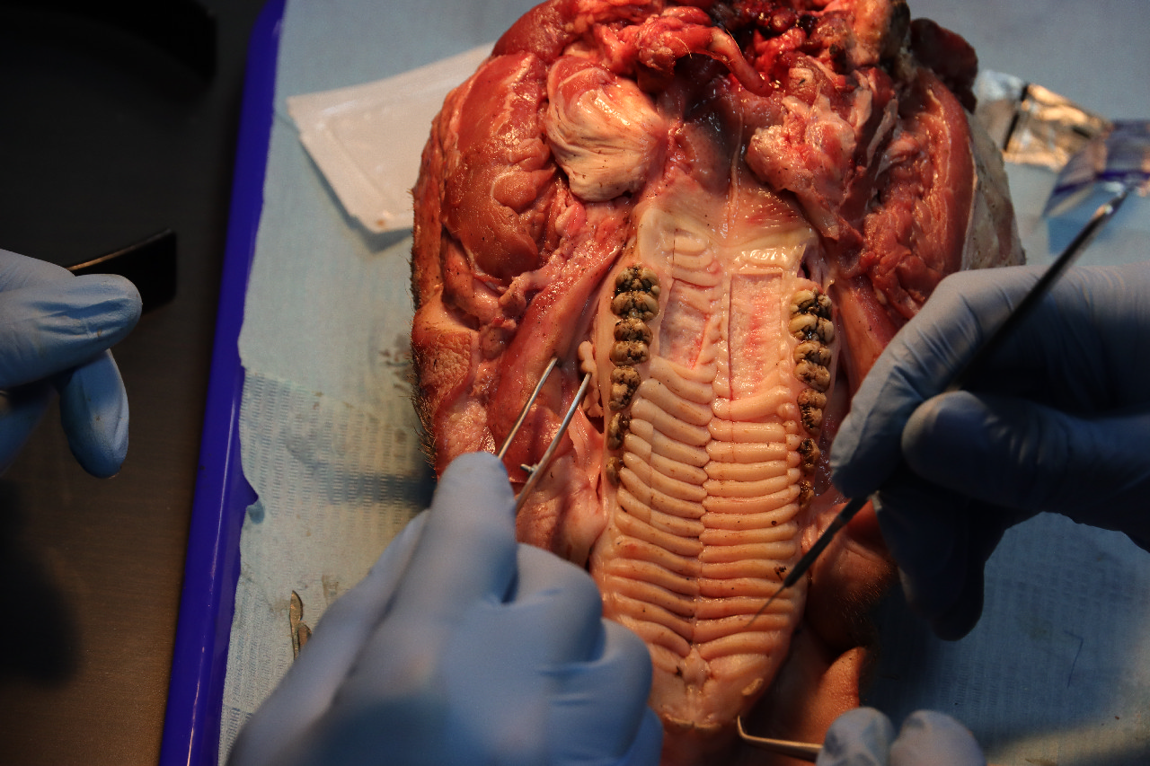 Пластика мягких тканей вокруг имплантатов. Морфологический подход