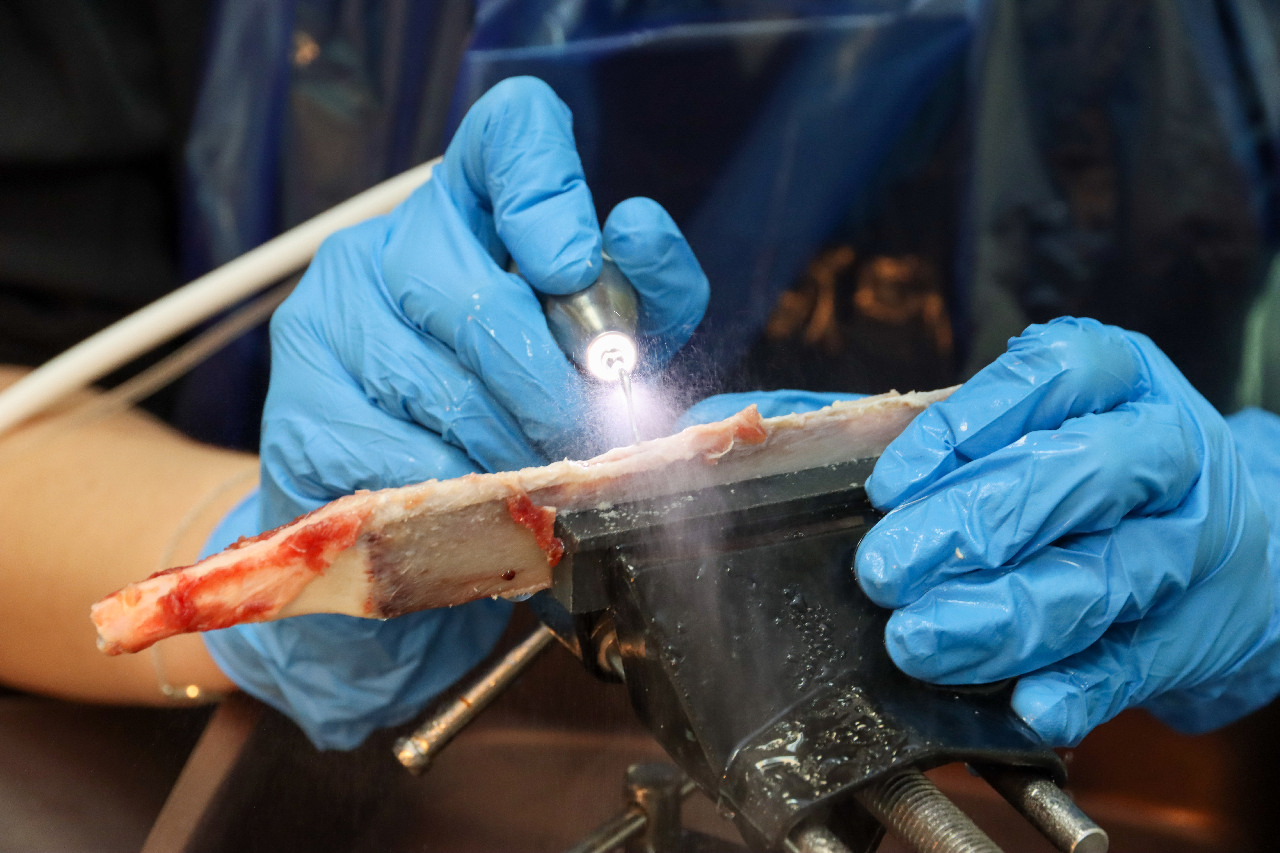 Продвинутый курс по имплантации. Костная пластика и синус-лифтинг