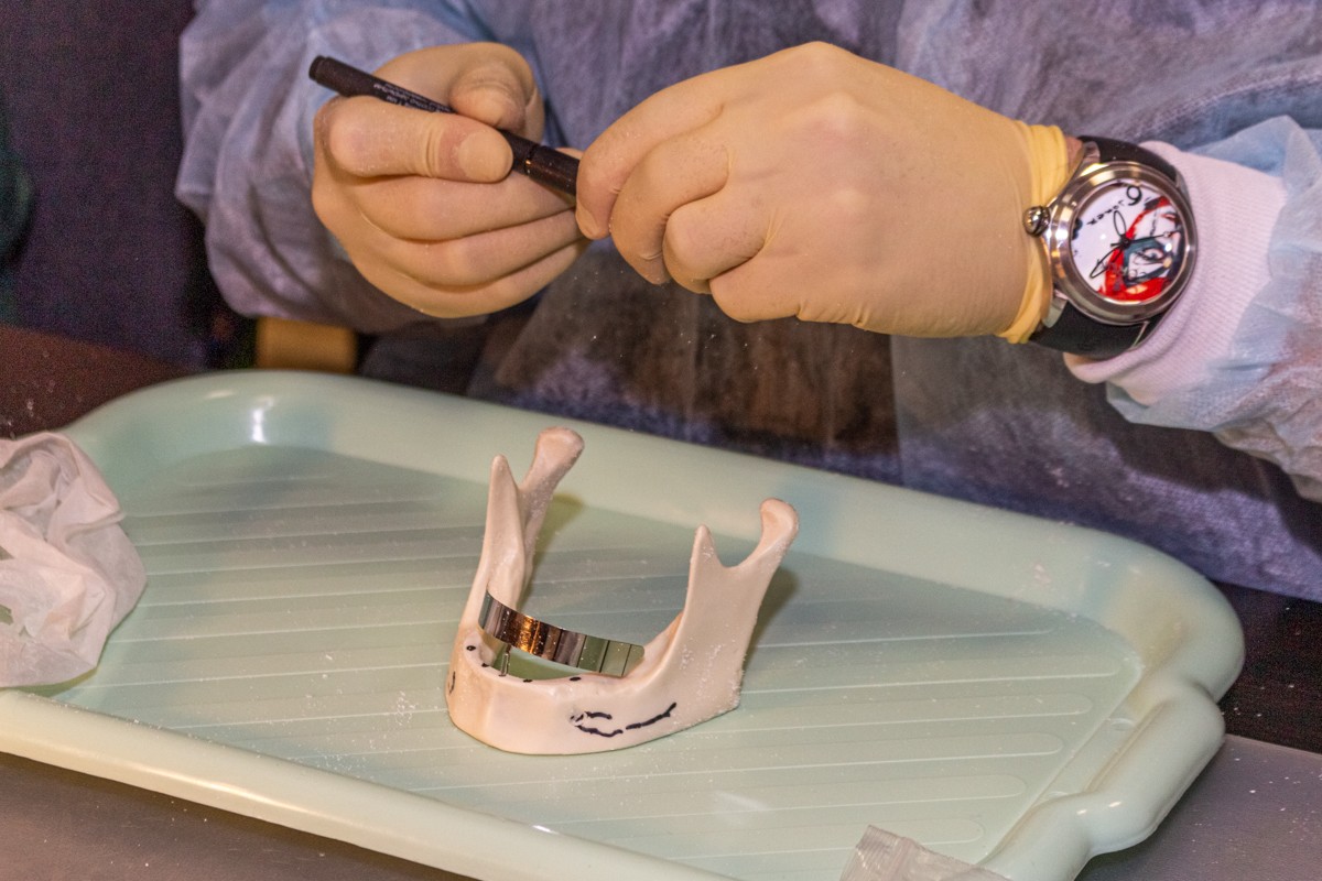 Стоматологическая реабилитация с помощью ангулированных имплантатов. 5 февраля 2020, Данилов Александр Алексеевич