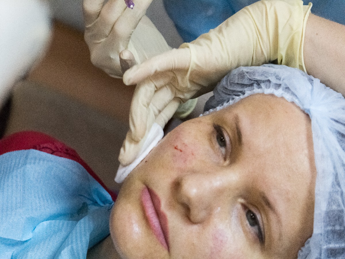 Применение плазмы с высоким содержанием фибрина (IPRF) в эстетической медицине