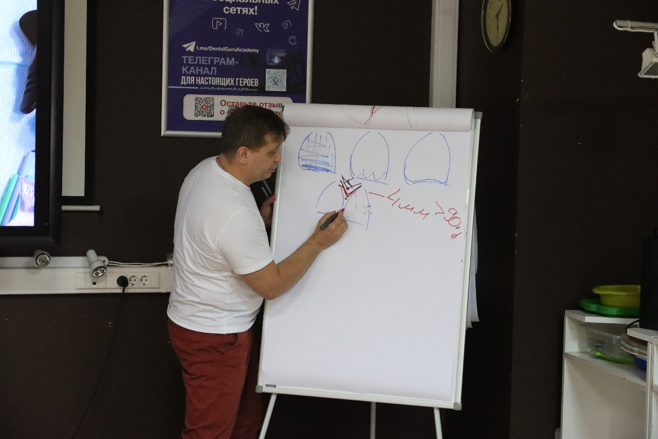 Прямые композитные виниры. Полный алгоритм и немного больше