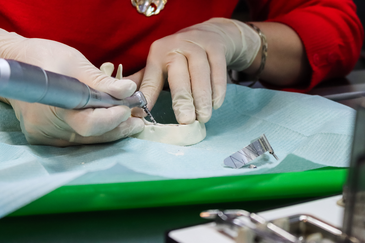 Стоматологическая реабилитация с помощью ангулированных имплантатов, 25.02.2022