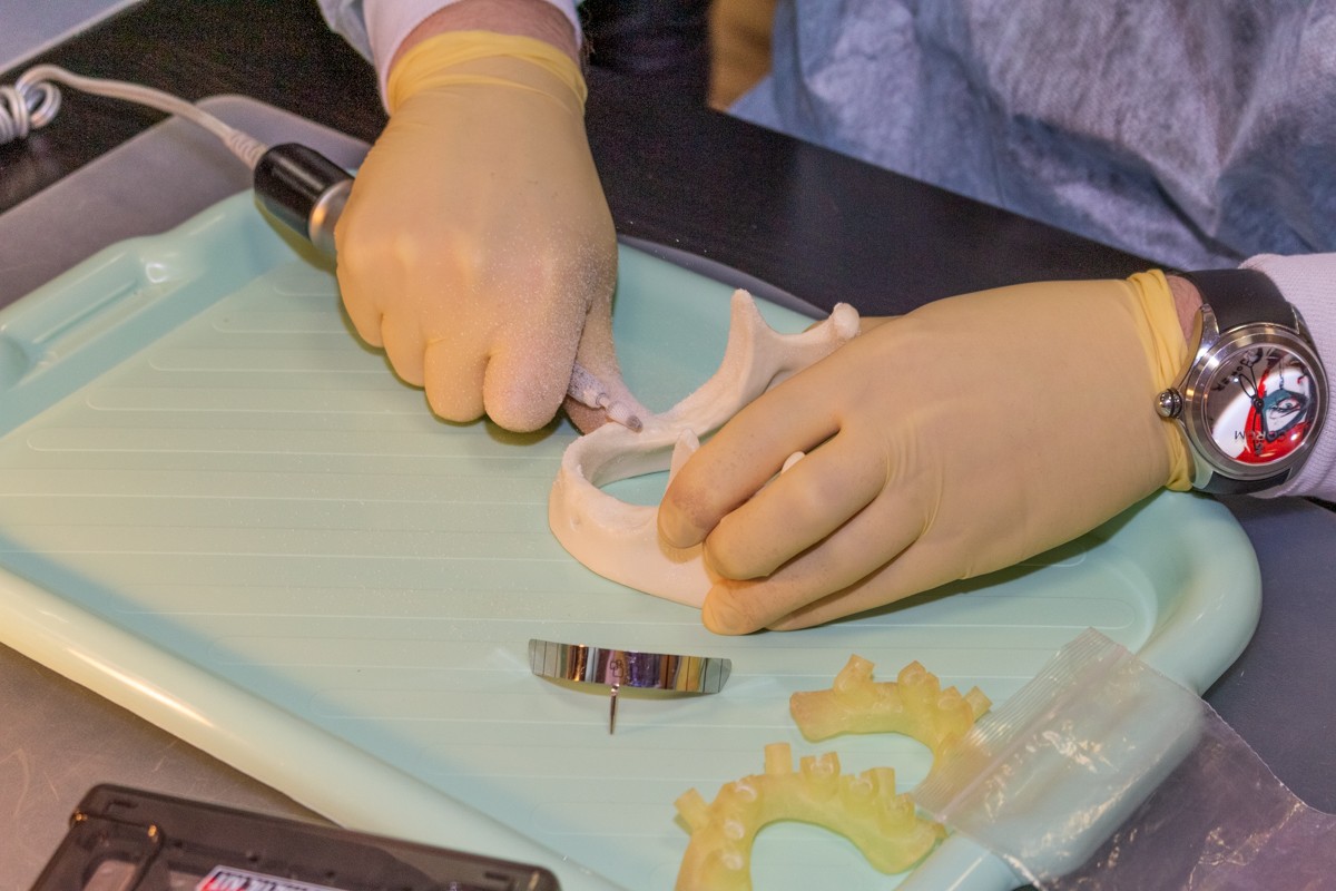 Стоматологическая реабилитация с помощью ангулированных имплантатов. 5 февраля 2020, Данилов Александр Алексеевич