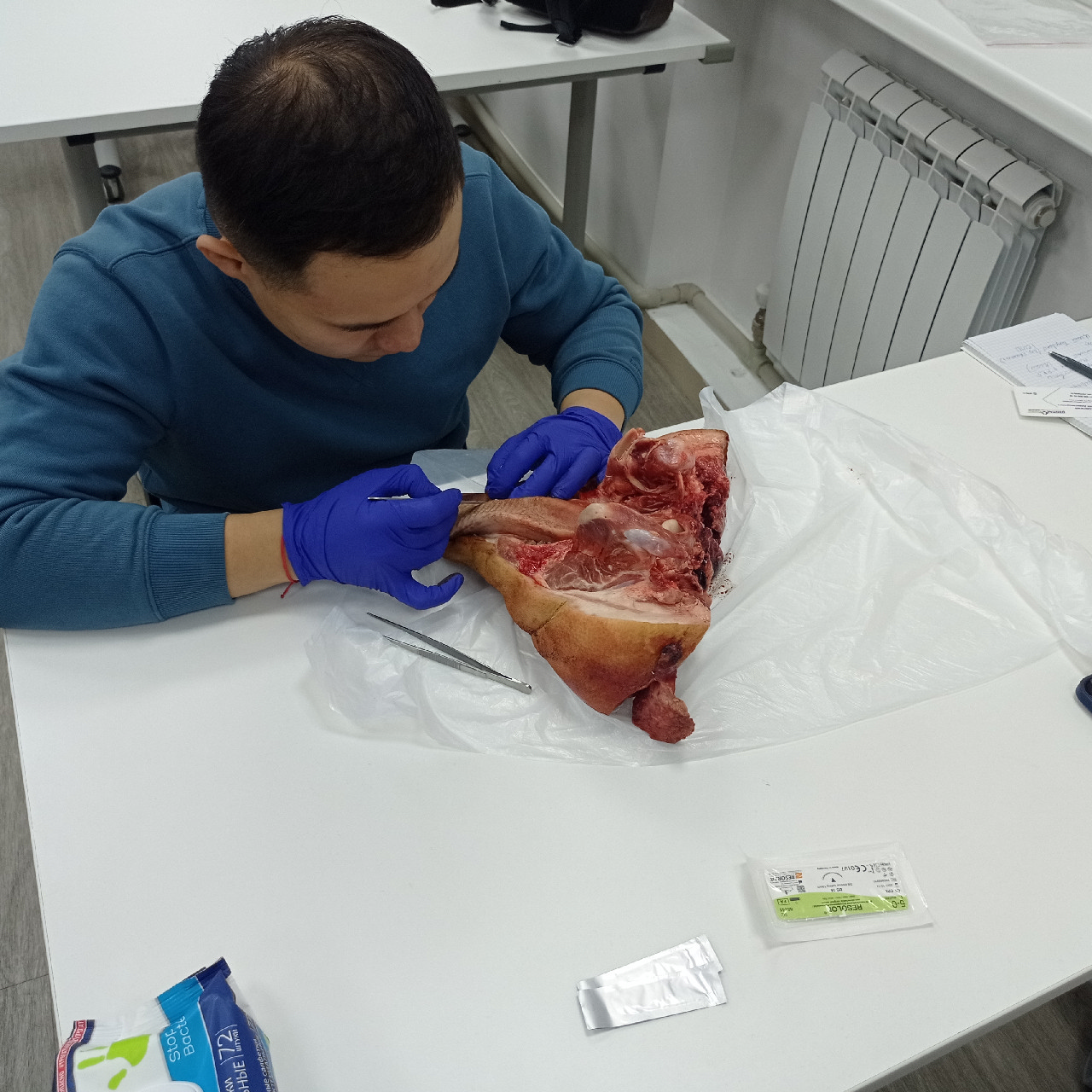 Пластика мягких тканей вокруг имплантатов. PRF в стоматологии. Курс в Казахстане