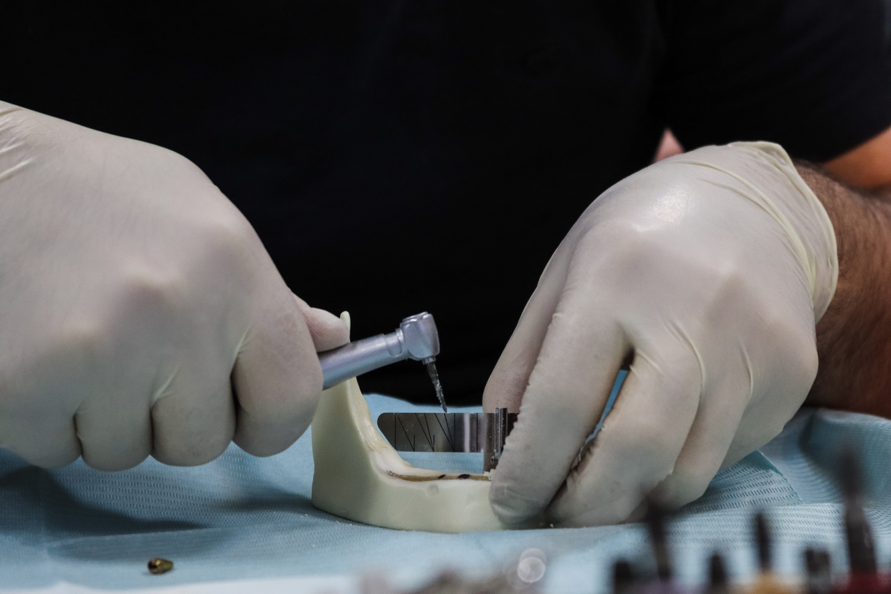 Стоматологическая реабилитация с помощью ангулированных имплантатов, 25.02.2022