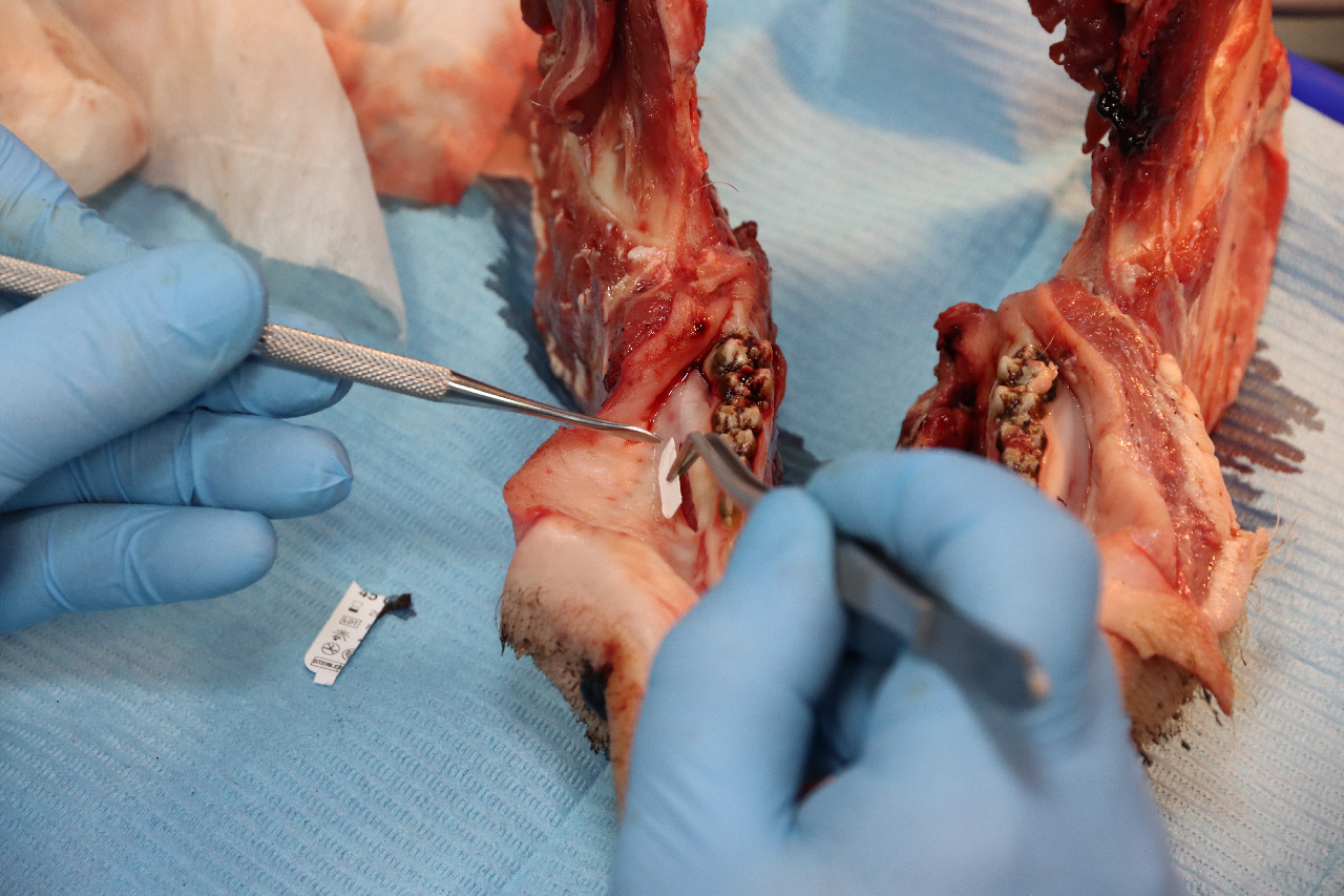 Продвинутый курс по пластике мягких тканей