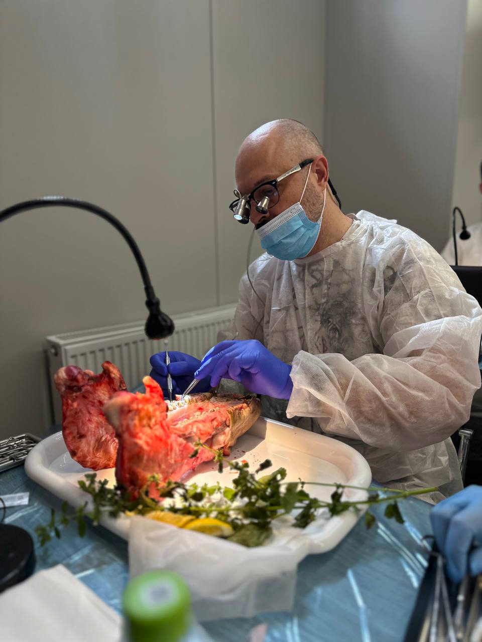 Пластика мягких тканей в периимплантатной области