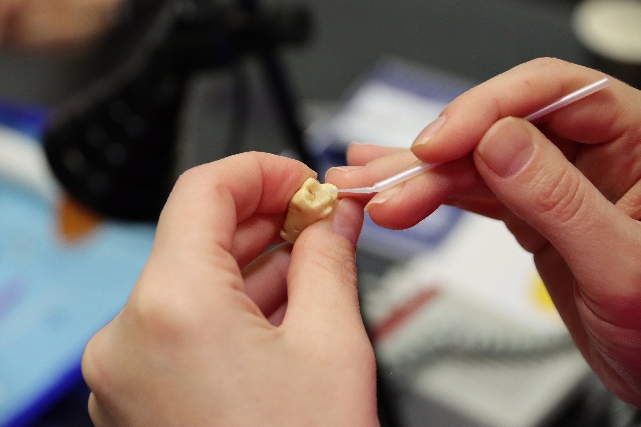 Прямые методы реставраций жевательной группы зубов