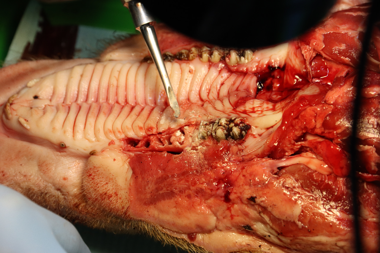 Атравматичное удаление зубов и методики наложения швов