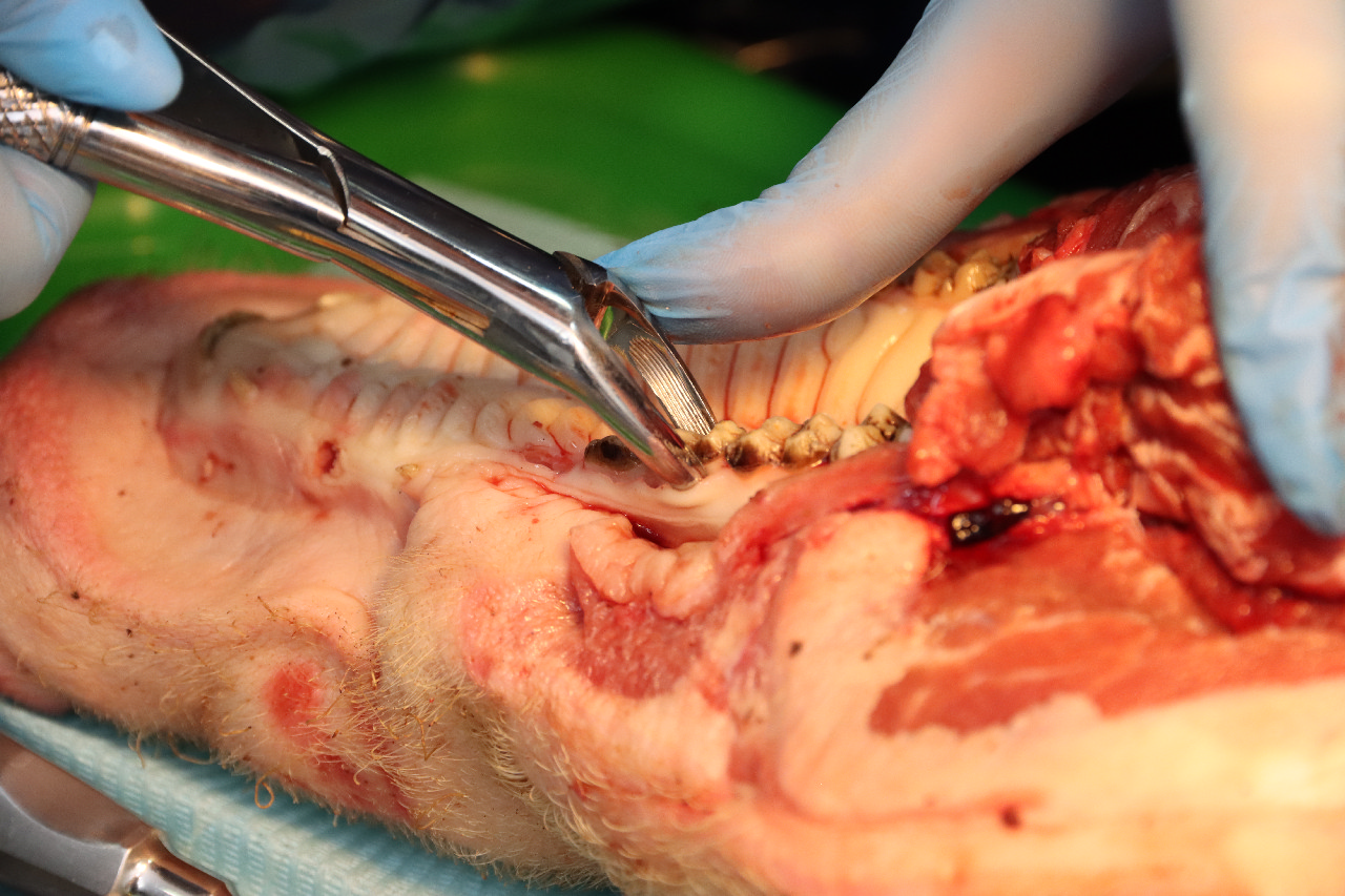 Атравматичное удаление зубов и методики наложения швов