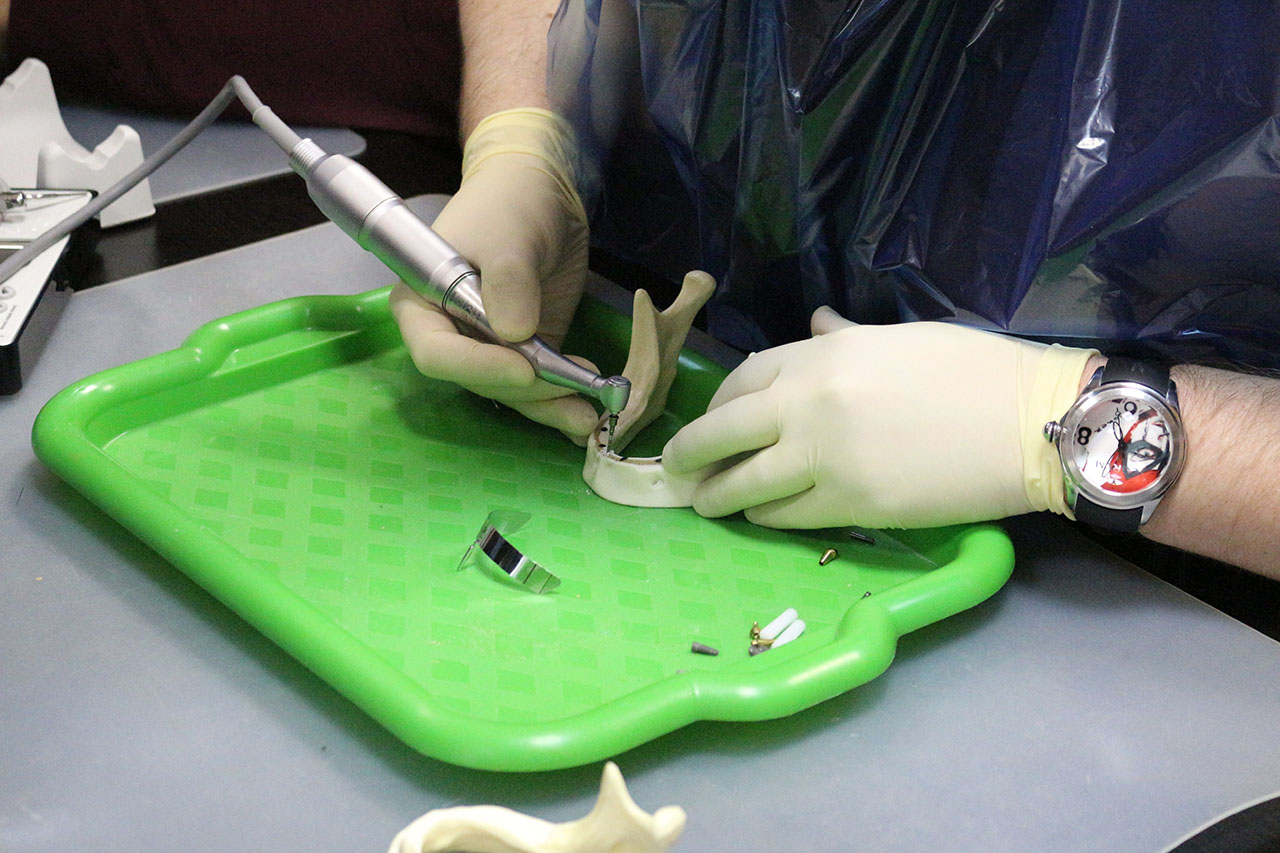 Стоматологическая реабилитация с помощью ангулированных имплантатов. Пост-релиз 4 декабря