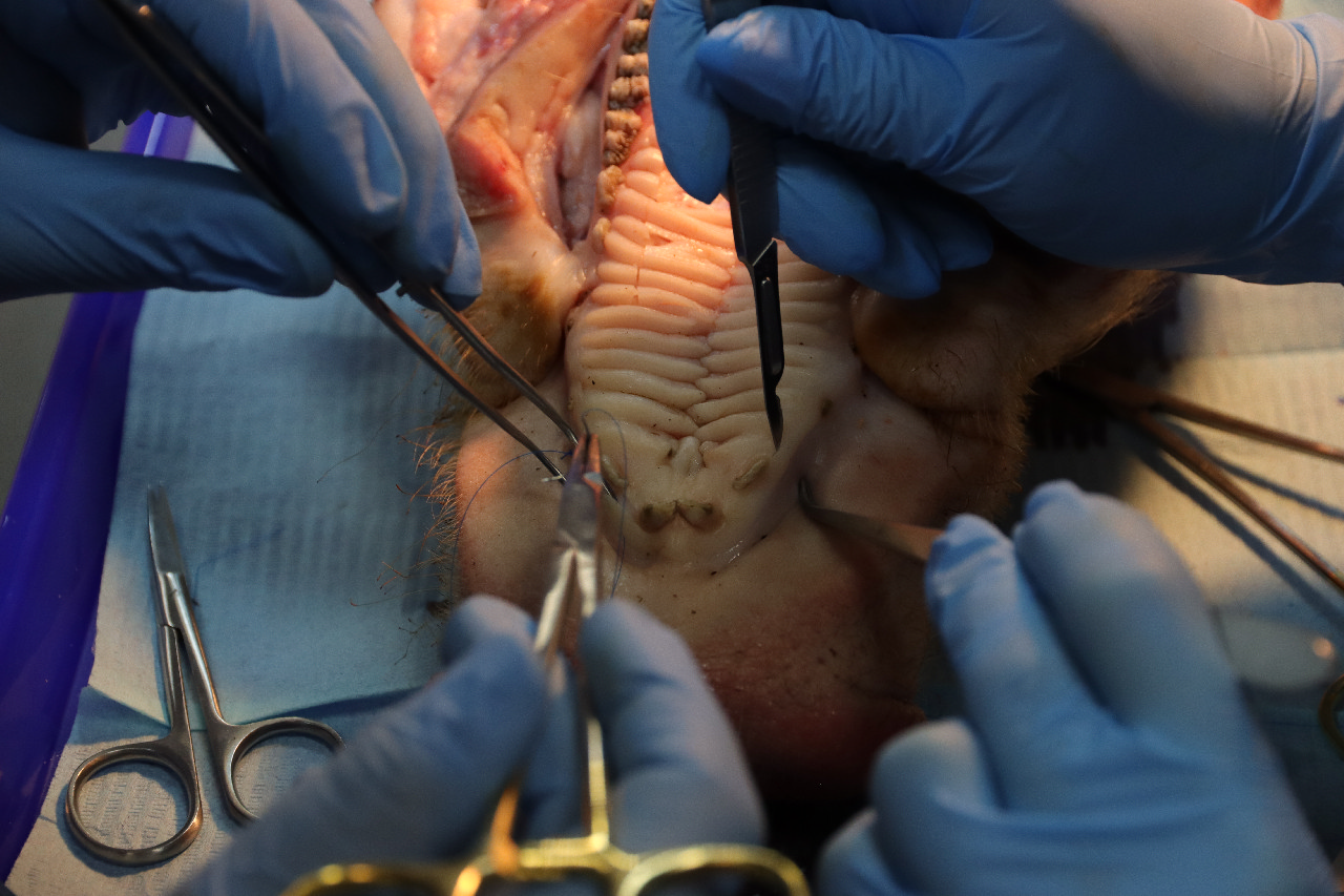 Пластика мягких тканей вокруг имплантатов. Морфологический подход