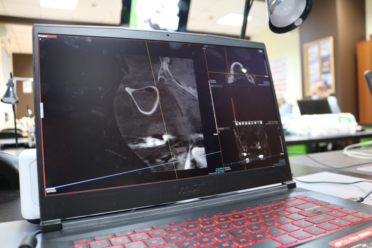 Пост-релиз. Кадавер-курс 1 марта