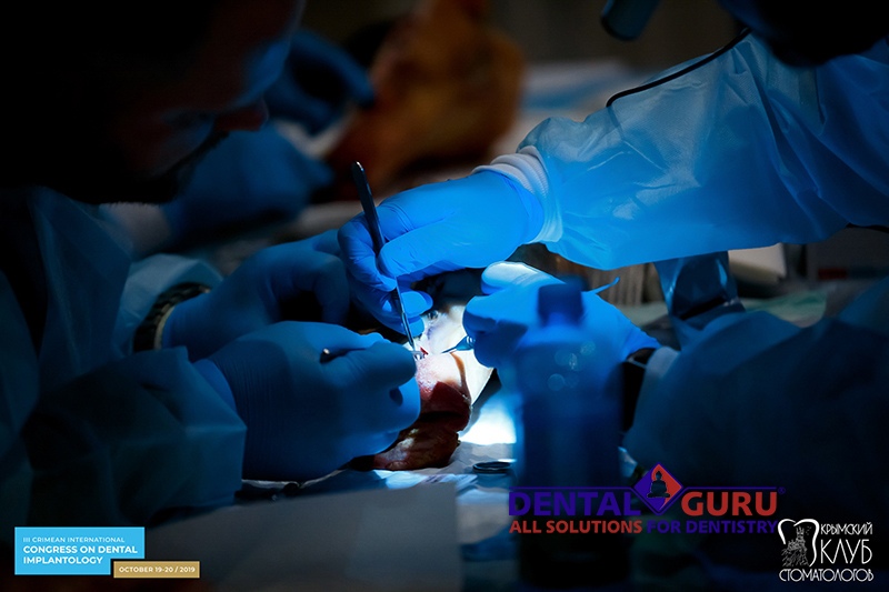 19-20 октября 2019. III Международный имплантологический конгресс в Ялте