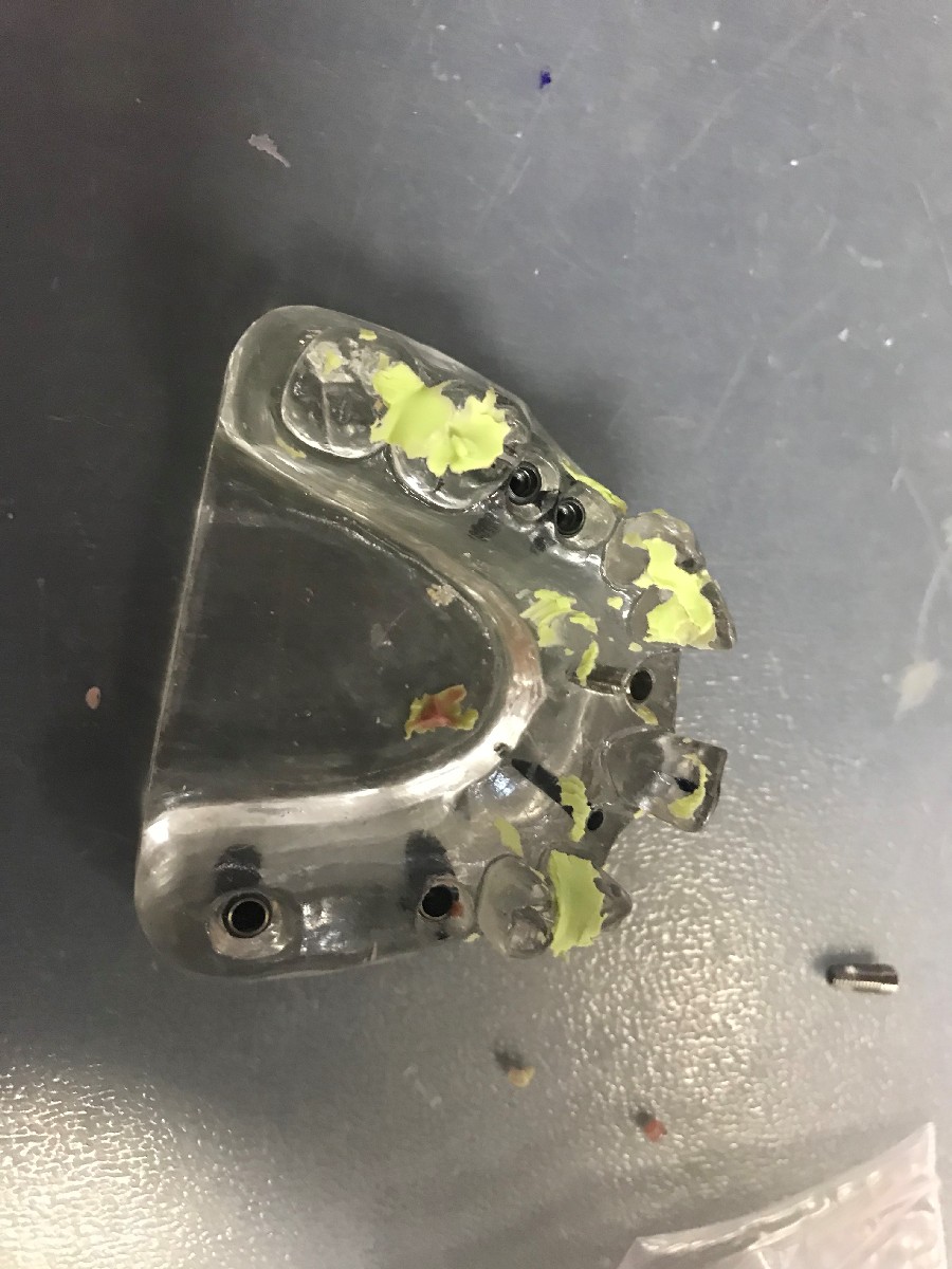 Базовый курс по имплантации, 14-15 марта 2020г.