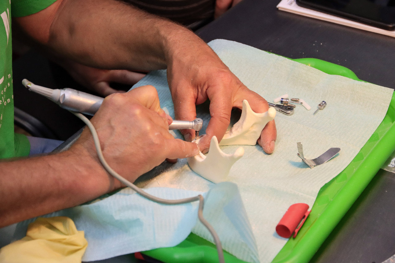 Стоматологическая реабилитация с помощью ангулированных имплантатов