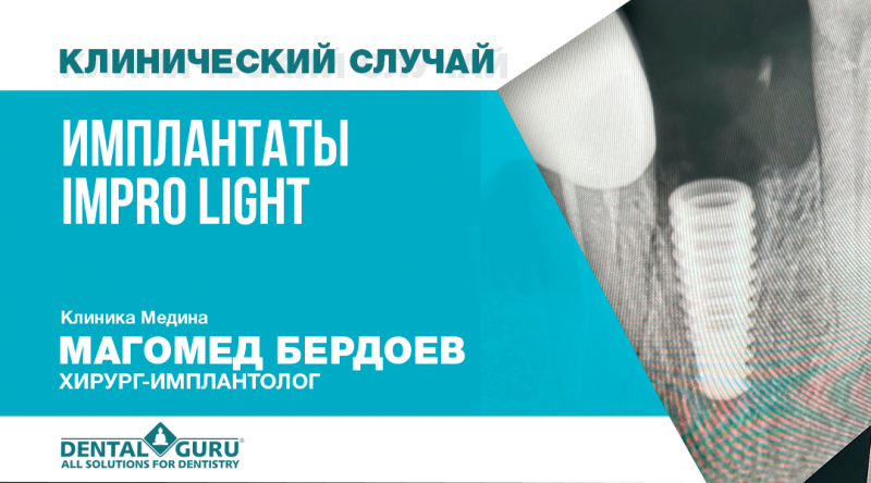 Клинический случай Impro Light