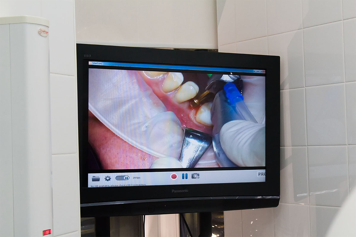 Модульный курс - Обучение секретам и нюансам имплантации на практике в условиях клиники