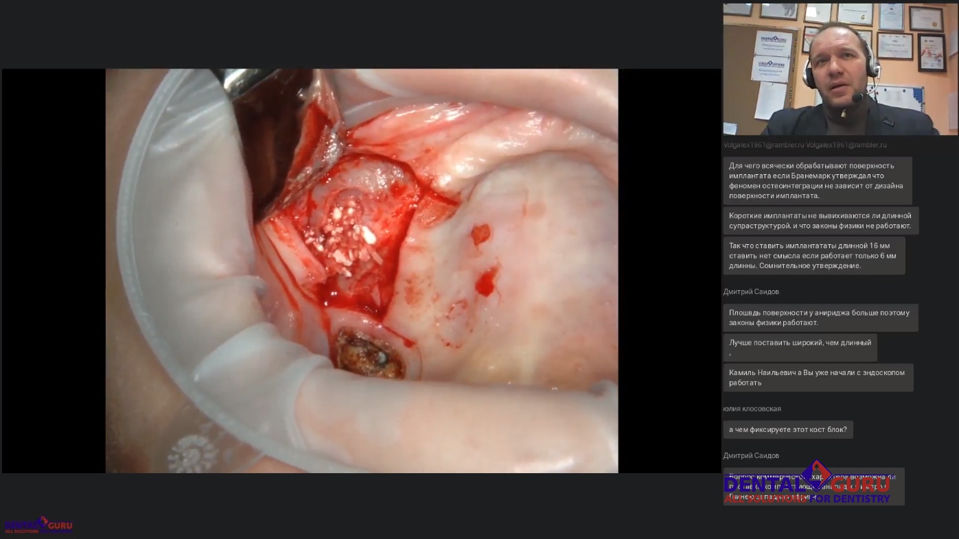 Пост-релиз: Взаимодействие имплантолога и лор-врача при проведении имплантации и костной пластики в компрометированной пазухе