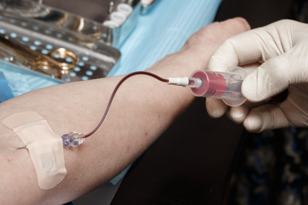 Применение факторов роста (IPRF, APRF) в стоматологии