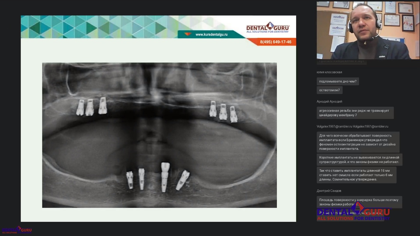 Пост-релиз: Взаимодействие имплантолога и лор-врача при проведении имплантации и костной пластики в компрометированной пазухе