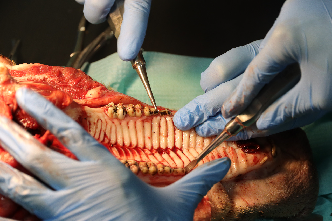 Атравматичное удаление зубов и методики наложения швов