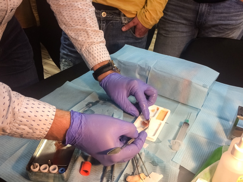 Атравматичное удаление зубов и методики наложения швов