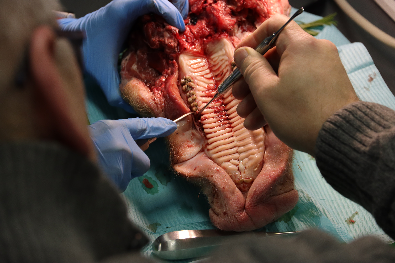 Атравматичное удаление зубов и методики наложения швов