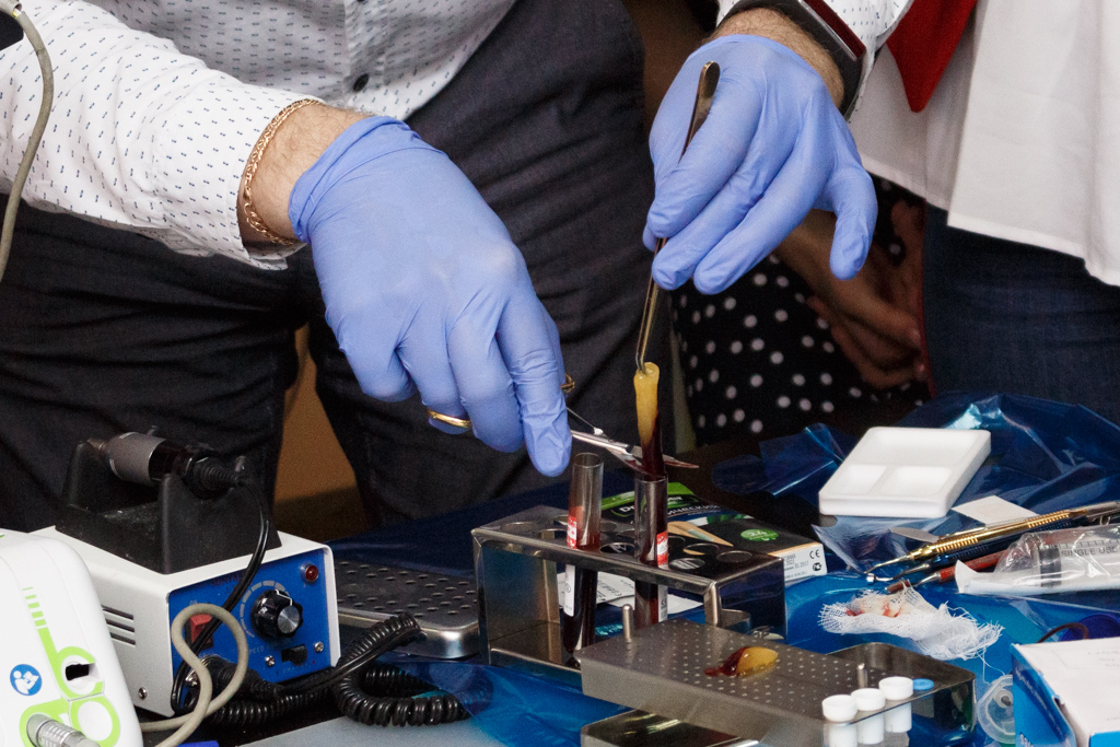 Атравматичное удаление зубов и методики наложения швов