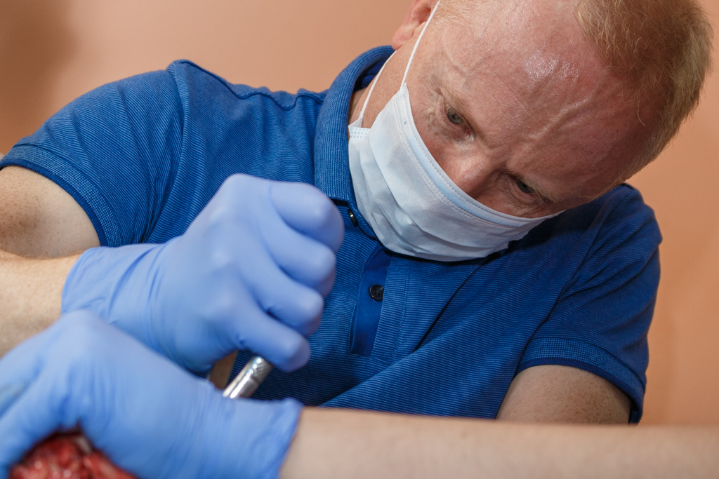 Атравматичное удаление зубов и методики наложения швов