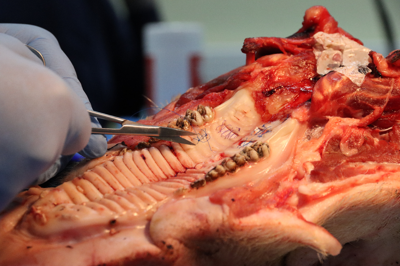 Продвинутый курс по пластике мягких тканей