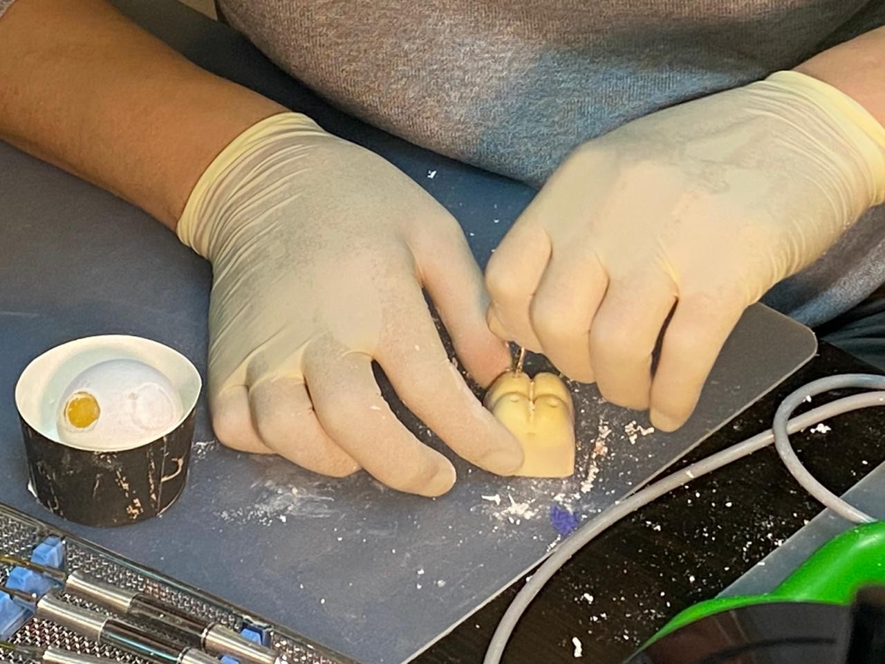 Пост-релиз "Продвинутый курс по имплантации.  Костная пластика"