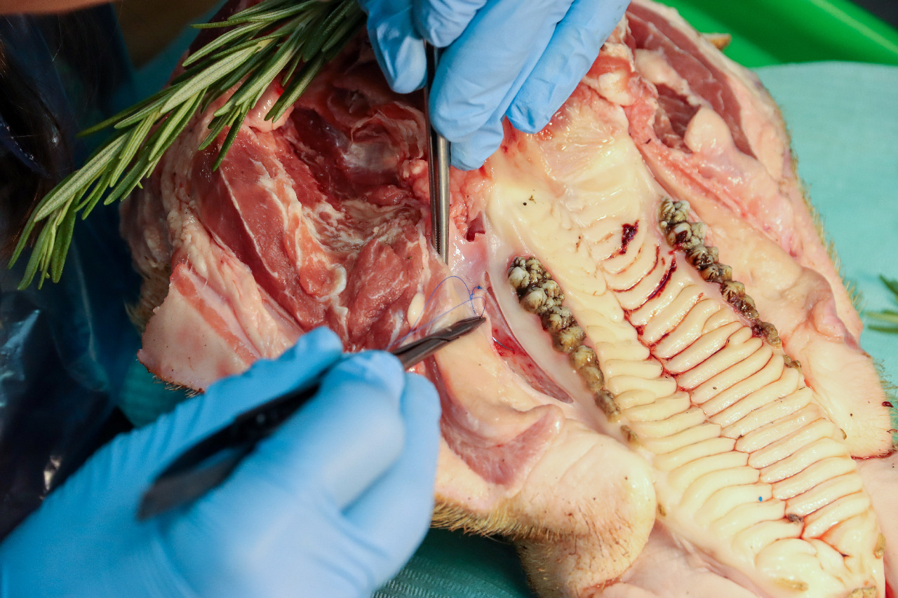 Пластика мягких тканей вокруг имплантатов. Морфологический подход. Пост-релиз 15-16 сентября