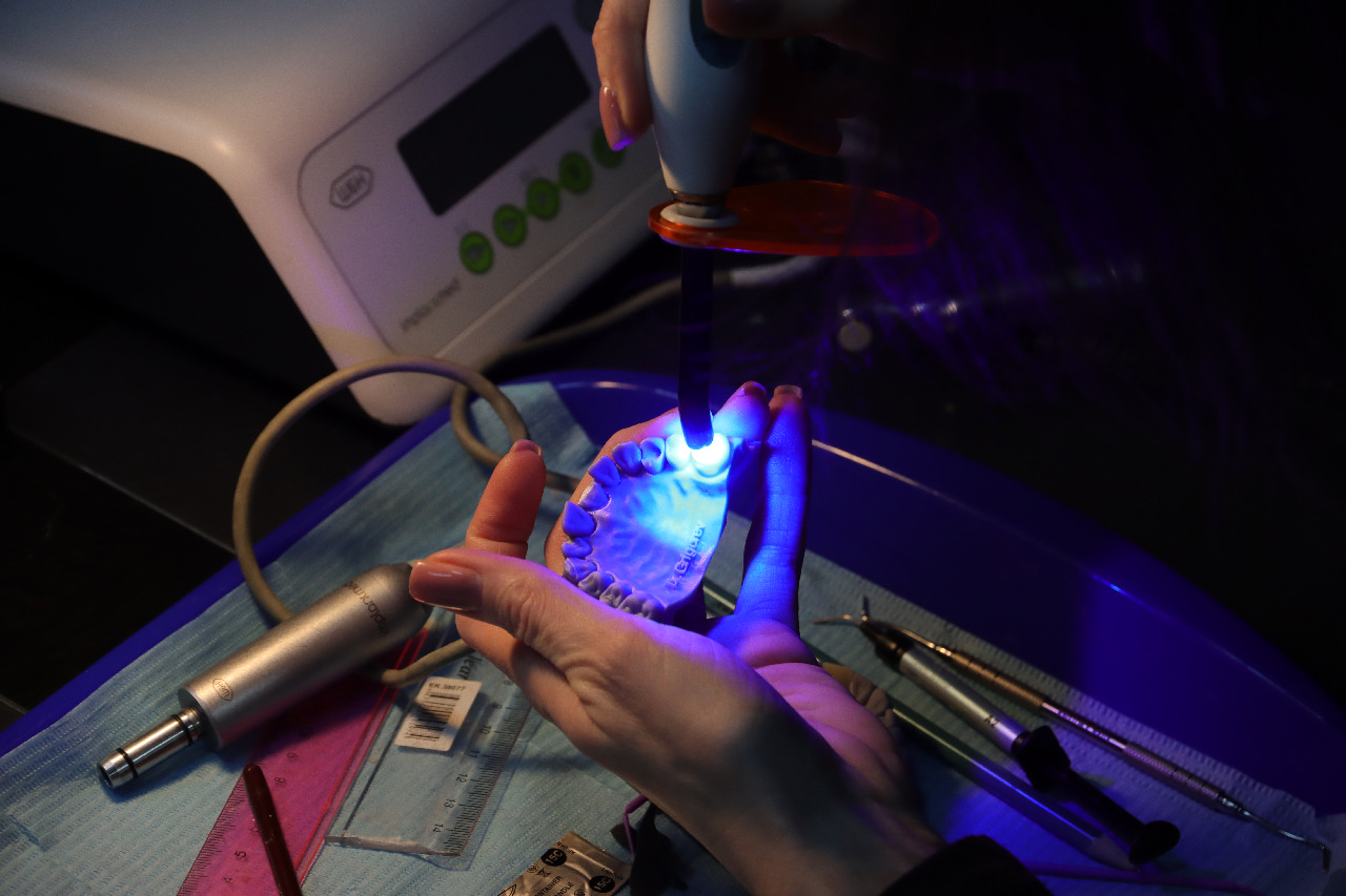 Прямые композитные виниры. Полный алгоритм и немного больше