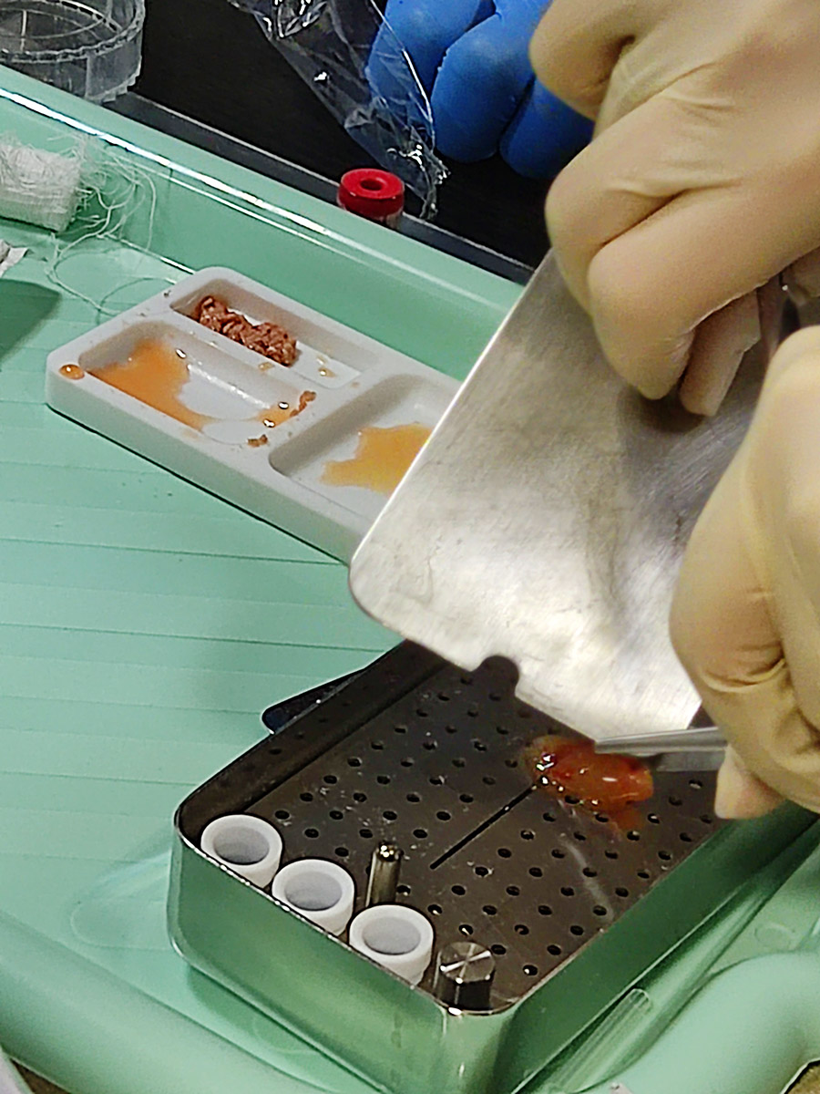 Плазмотерапия PRF в стоматологии. Пост-релиз 2 сентября