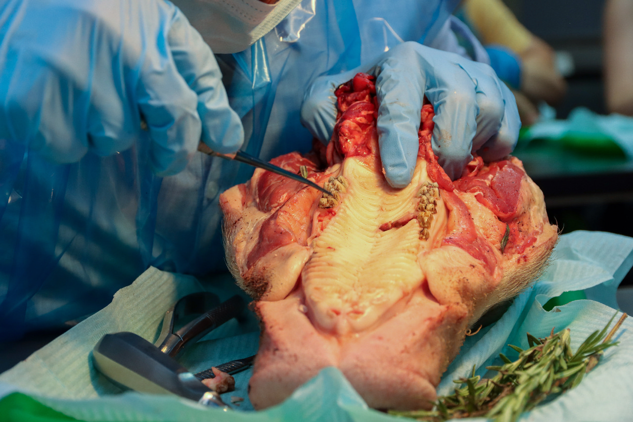 Атравматичное удаление зубов и методики наложения швов