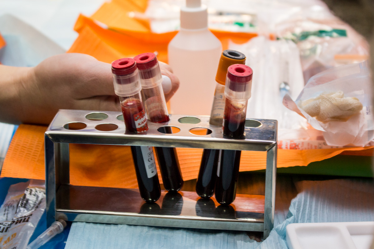 Применение факторов роста (I-PRF, A-PRF) в стоматологии