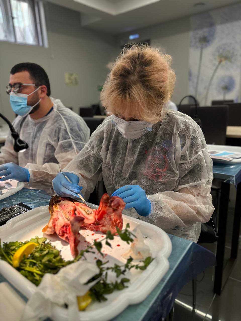 Пластика мягких тканей в периимплантатной области