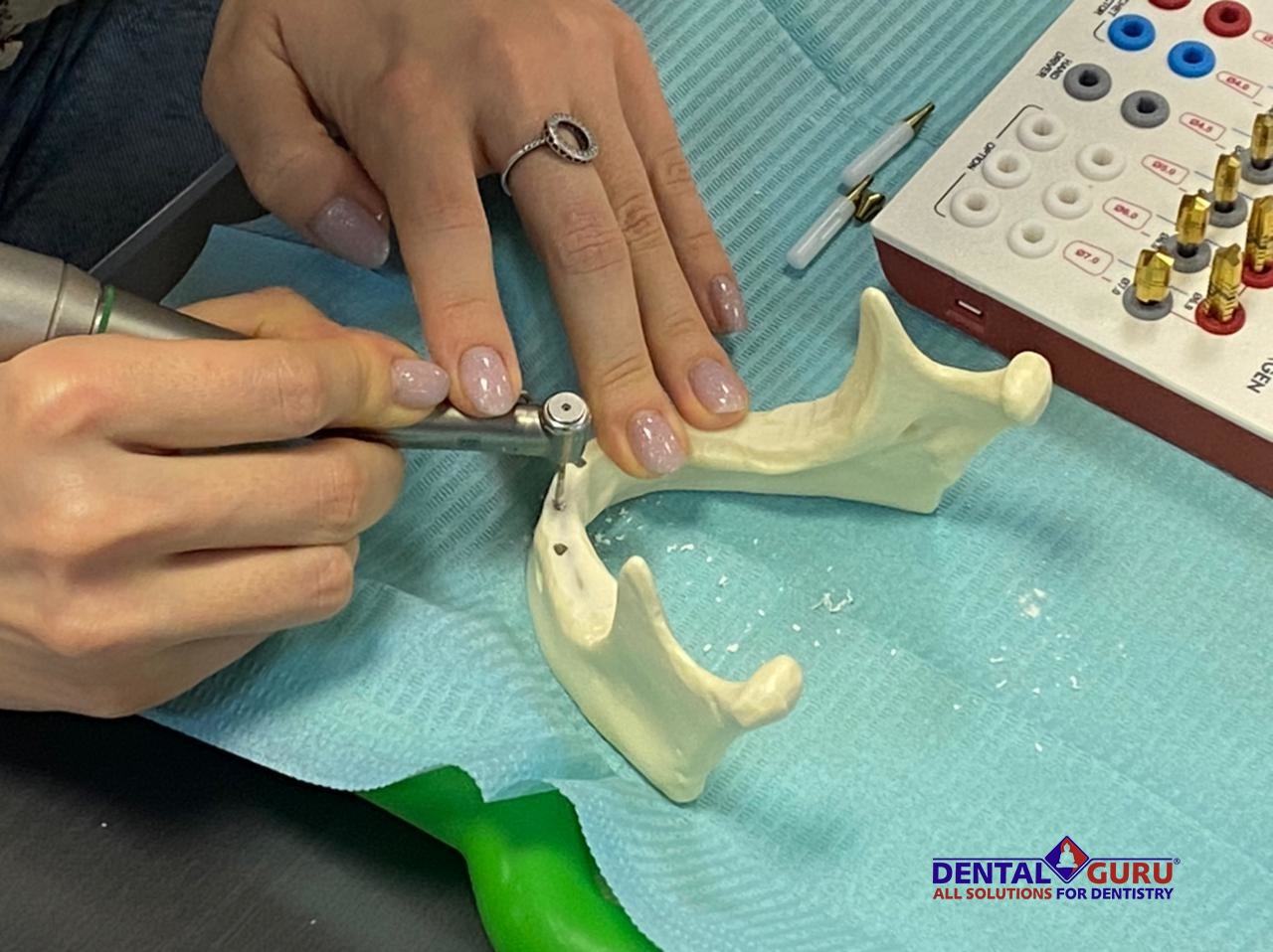 «Стоматологическая реабилитация с помощью ангулированных имплантатов. Имплантация на 4-х имплантатах. Физиологическое и анатомическое обоснование». Пост-релиз 31.01.21