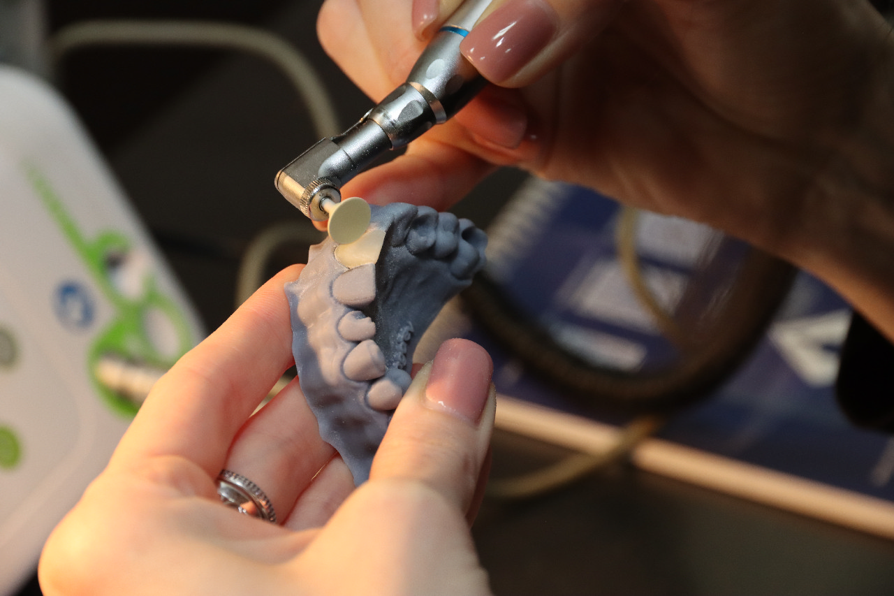 Прямые композитные виниры. Полный алгоритм и немного больше