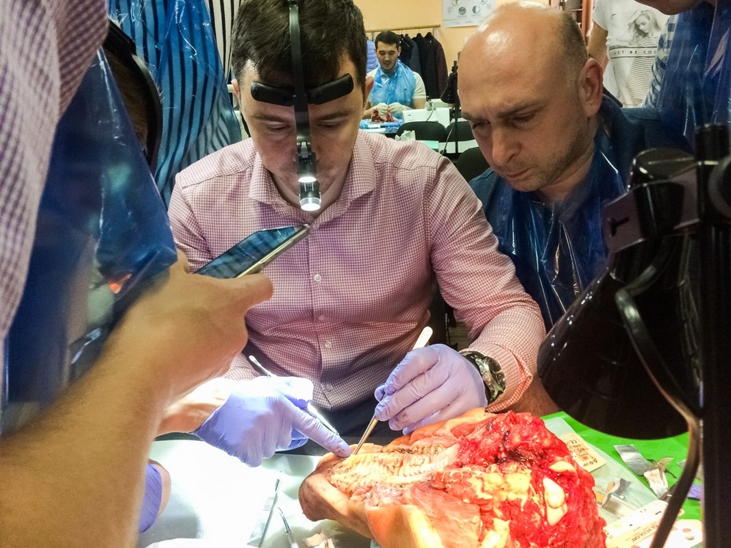 Пластика мягких тканей вокруг имплантатов. Морфологический подход