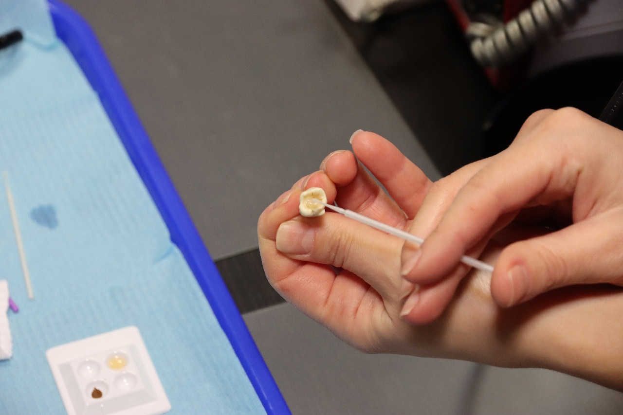 Прямые методы реставраций жевательной группы зубов